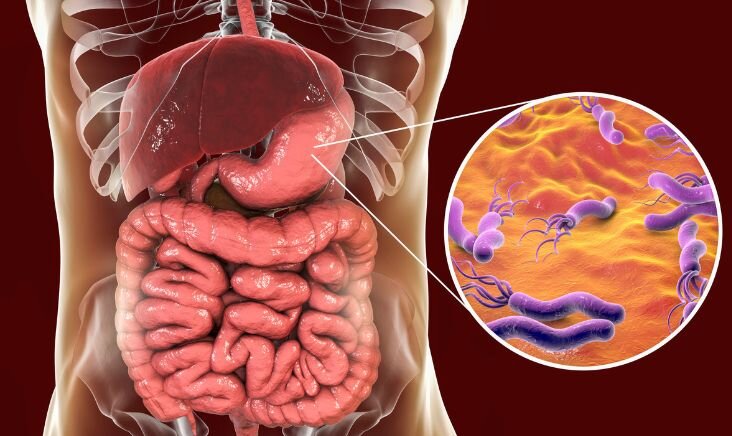 Cover image for The Gut Cancer Connection