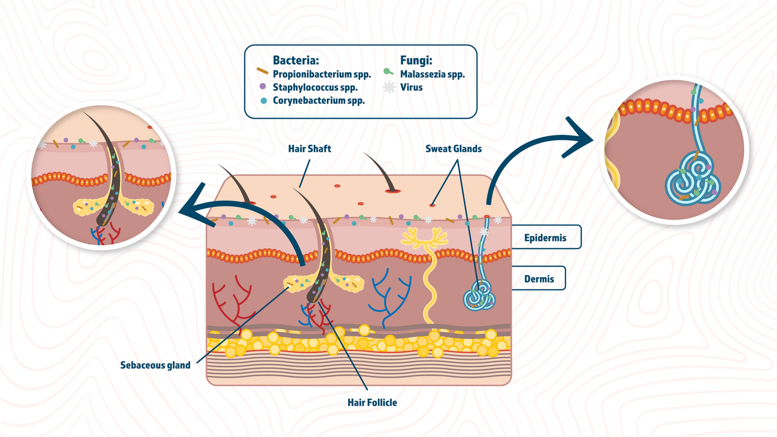 Acne and the Gut Microbiome: How gut dysbiosis, LPS inflammation, and SCFA deficiency contribute to acne formation