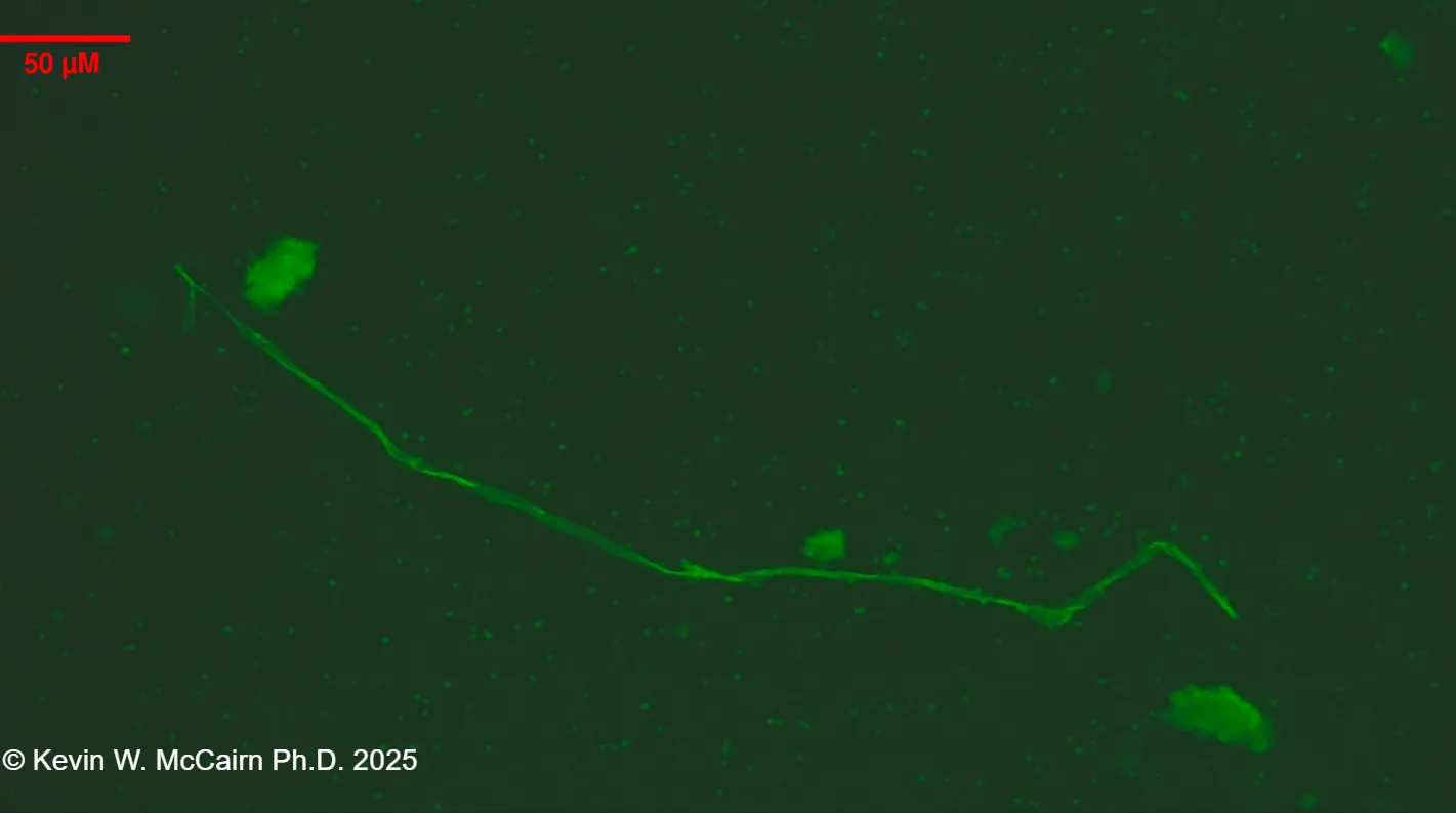Representative image from Slide 18 UV ThT fluorescence