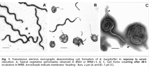 Borrelia cystic forms under microscopy