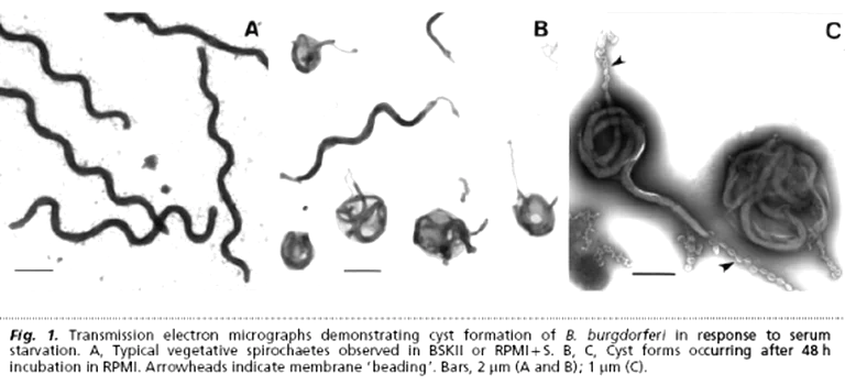 Borrelia cystic forms under microscopy