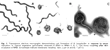 Borrelia cystic forms under microscopy