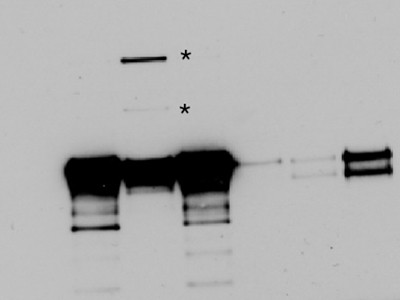 Detailed diagram comparing unmodified vs m1Ψ-modified mRNA showing ribosomal stalling and +1 slip at slippery sites