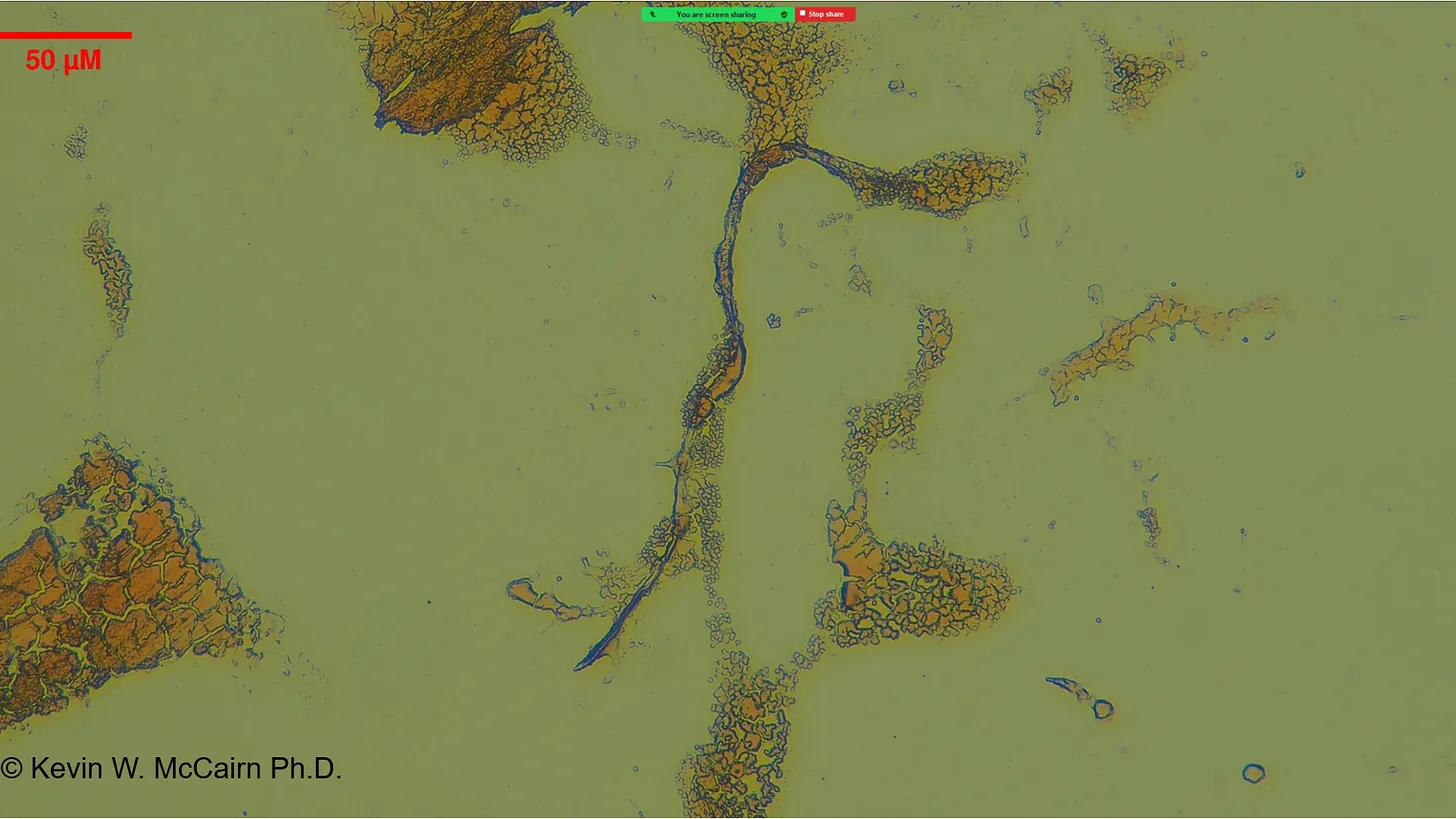 Light microscopy of resistant fibrin aggregates at 50um scale