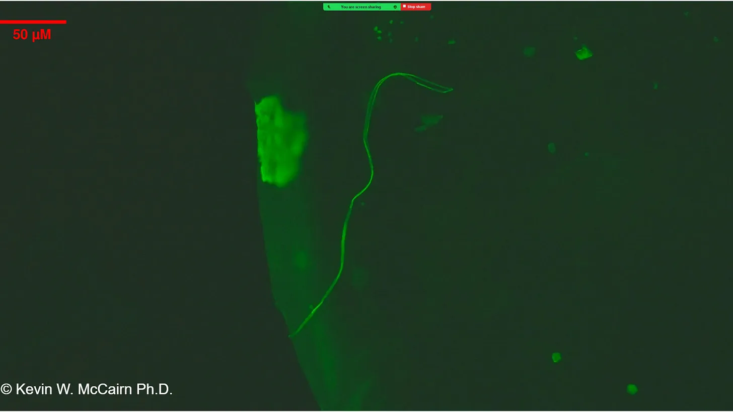Thioflavin T micrograph showing amyloid fibrils positive for pathological aggregates